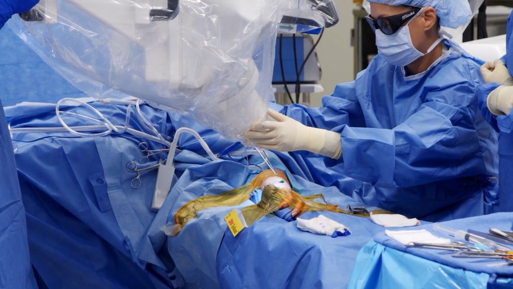 Lymphedema Surgery with Symani